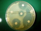 細菌感染でハッピー動物病院へ来院した症例の、細菌培養感受性検査結果の写真です。
